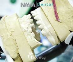 Slider image (4) Nava Dental Care